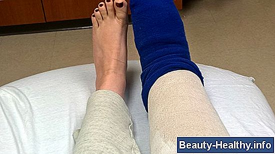 Sådan Wrap Legs for Lymphedema