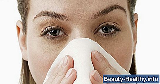 High Histamine Foods