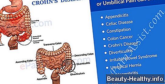 Burst Hernia Symptomer