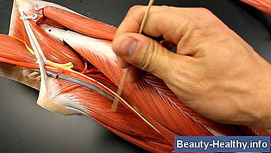 Femoral Artery Pain