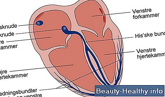 Hvad er en Muscle Tear?