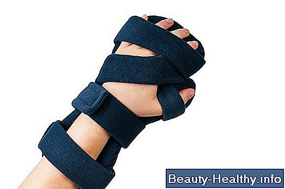 Wrist Splints vs håndled-hånd-finger Orthotics