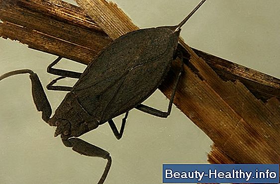 Hvilke insekter infesterer det menneskelige hår?