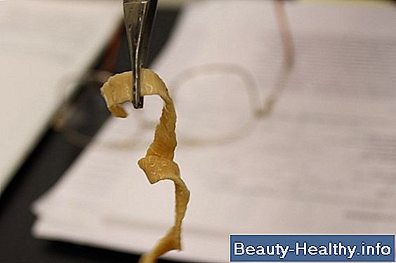 Over Counter Pinworm Treatment