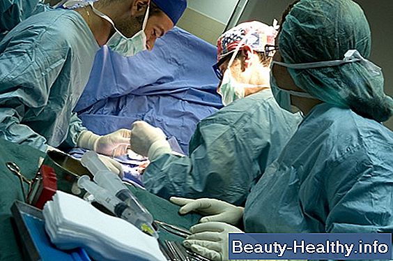 Anatomie associée à une césarienne