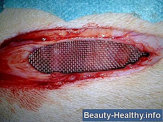 Causes de la douleur abdominale gauche