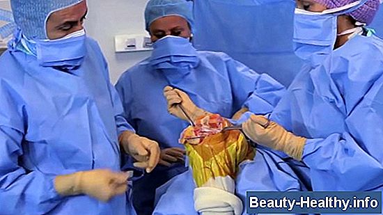 Chirurgie partielle de remplacement du genou