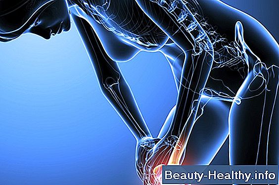 Comment diagnostiquer la polyarthrite rhumatoïde contre l'arthrose