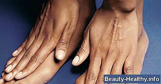 Hjemmelaget Remedy for Nail Keratin Debris Removal