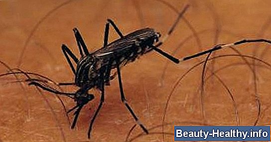 C贸mo distinguir una picadura de mosquito de otras picaduras de insectos