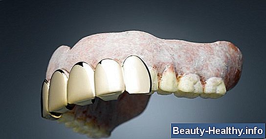 Cómo quitar la prótesis dental de acrílico