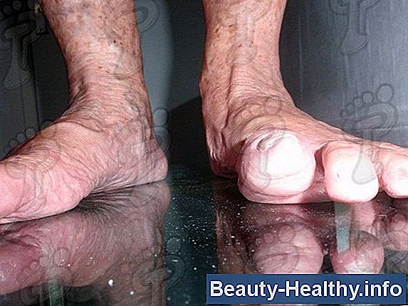 Flexor Allucis Longus Tendine Pain Relief