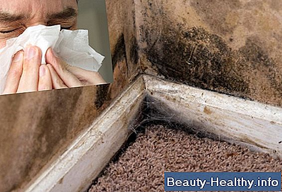 Signs & Symptoms of Mold Ingestion