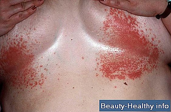 Quali sono le cause Itchy Pins & Needles Feelings On Skin?