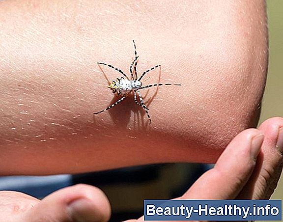 Wolf Spider Bite Symptoms