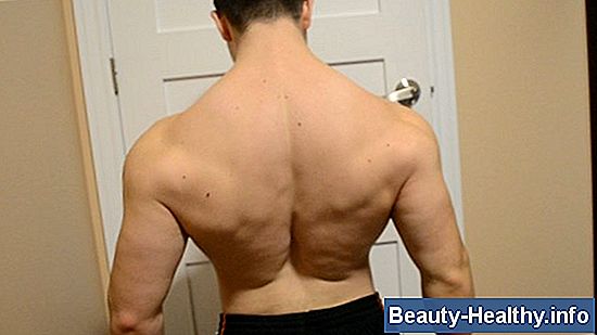 Back Strain vs. Herniated Disc