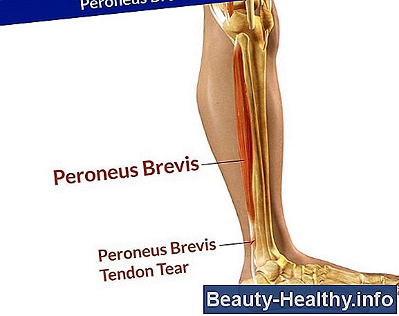 Flexor Hallucis Longus Tendon Pain Relief