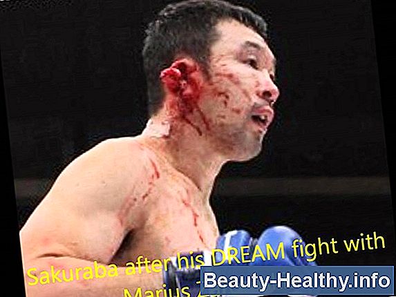 Kickboxing Injuries