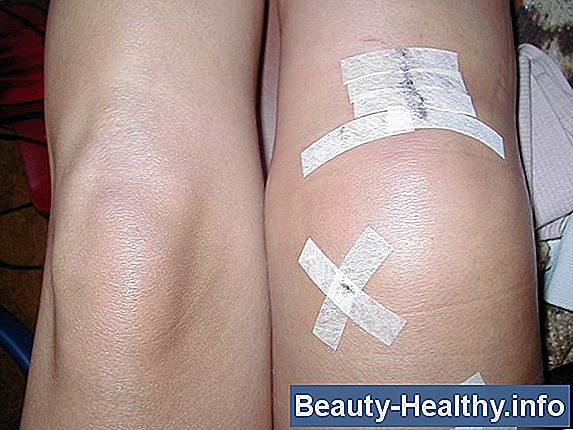 Meniscus Pain Relief