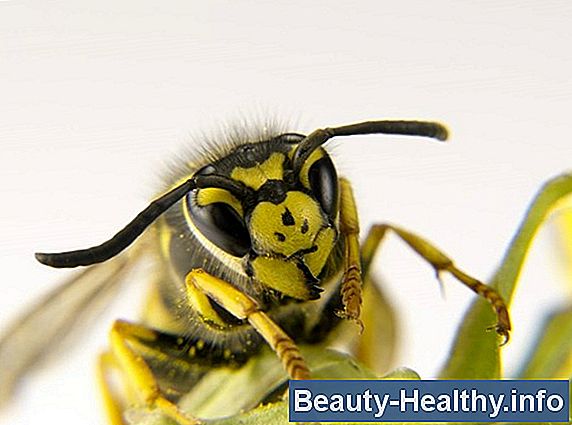 Comment traiter une piqûre d abeille qui est enflée et démangeaisons