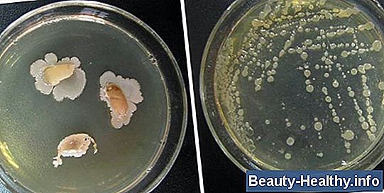 Klebsiella pneumoniae ja kuseteede infektsioonid