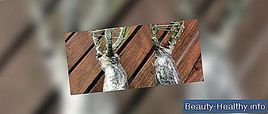 Näpunäited ja sümptomid vajadusest hambad asendamiseks