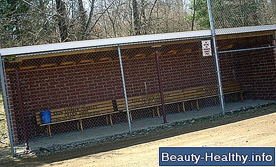 Cómo diseñar un dugout de béisbol