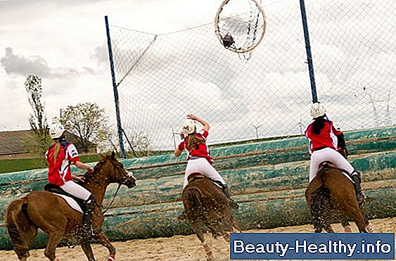 ¿Qué es un caballo PSG?