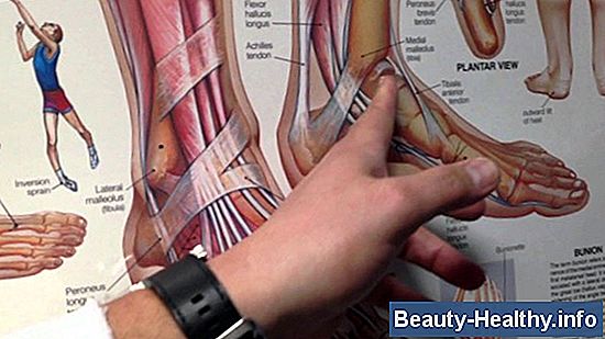 C贸mo caminar con neuropat铆a en los pies