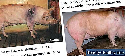 C贸mo rehabilitar un hombro despu茅s de una subluxaci贸n de hombro