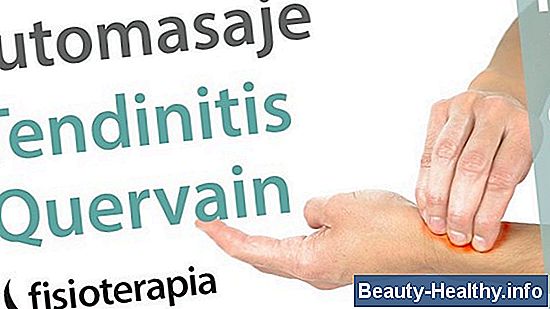 Ejercicios de tendinitis de Aquiles