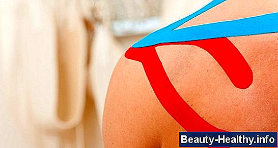 Kinesio Taping Techniques