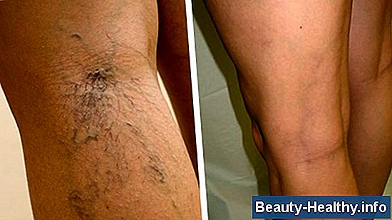 ¿Por qué los pies y las piernas se hinchan?