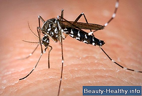 Acerca del dolor articular causado por virus