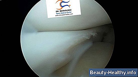 Cirug铆a de rodilla y dolor de cadera