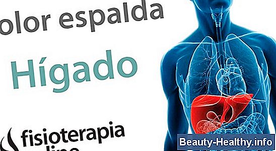 Síntomas de un músculo de costilla tirada