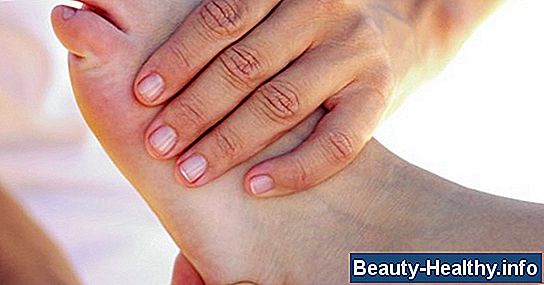 C贸mo tratar el dolor posterior a la culebrilla