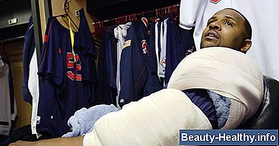 C贸mo tratar la tendinitis de Bowler