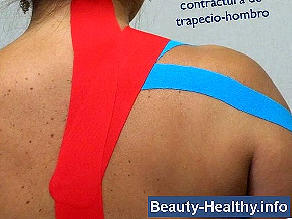 ¿Cuáles son las causas de rigidez después del reemplazo total de rodilla?