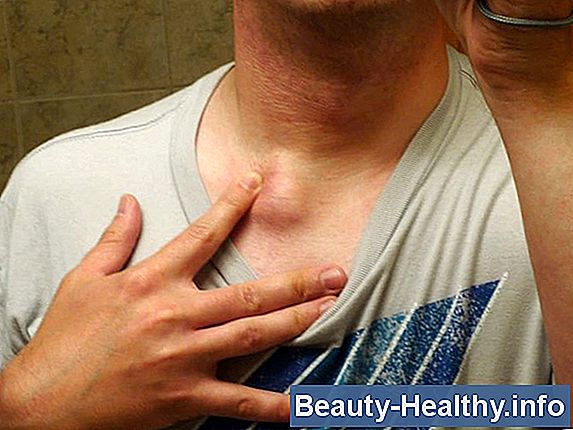 ¿Cuáles son las causas del dolor de cuello y la hinchazón en la parte posterior del cuello?