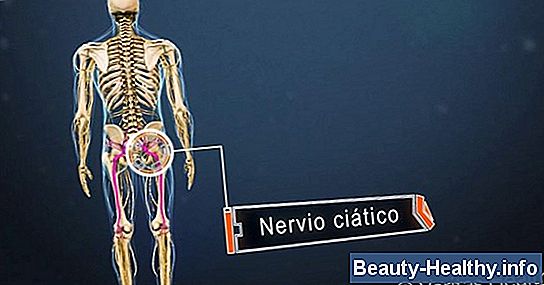 Dolor de cadera y muslo posparto