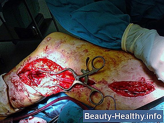 Dolor de la arteria car贸tida