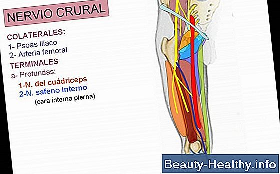 Dolor en la arteria femoral