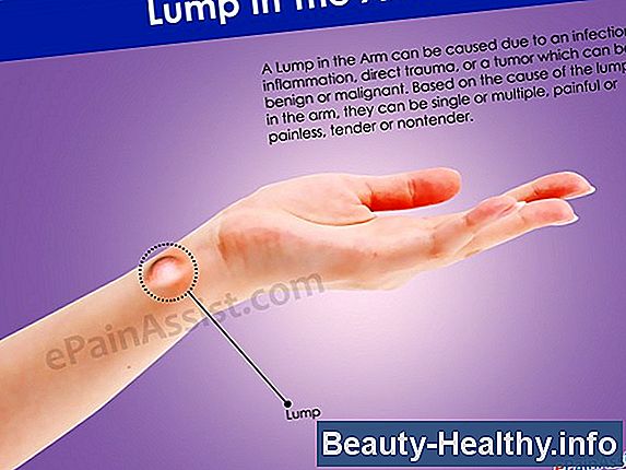 Fibromyalgia Knots