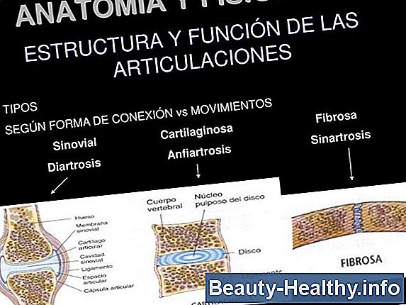 驴Qu茅 es el derrame de la articulaci贸n de la rodilla?