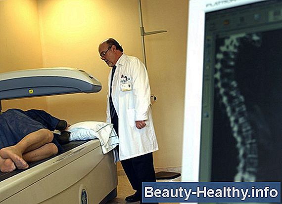 ¿Qué es la Radiculitis Lumbar?