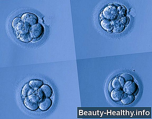 ¿Qué son los chequeos neurovasculares?