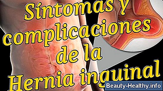 Signos y síntomas de hernia en la ingle