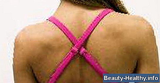 Síntomas de la artritis en el cuello y los hombros