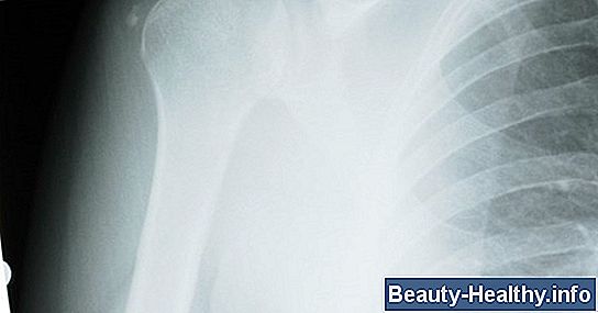 Síntomas de lesiones serias en el cuello en niños pequeños